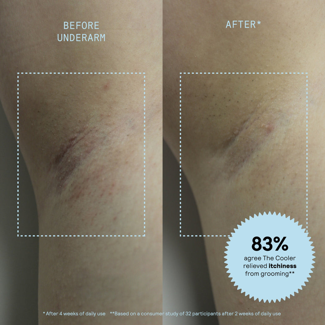Before and after comparison of underarm skin showing reduced redness and irritation after 4 weeks of daily use of Meridian grooming product.